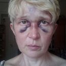 Тенденция насилия: в Одессе избивают активистов, выступающих против мэра Труханова