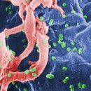 Медики: Вирус папилломы защищает от рака