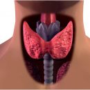 Щитовидная железа: шесть явных признаков того, что пора к врачу