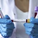 В украинских аптеках появятся тесты на коронавирус: сколько они будут стоить