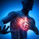 7 признаков того, что ваше недомогание связано с инфарктом
