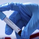 Тесты на коронавирус в Черновцах не являются достоверными