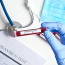 В Украине за время пандемии провели лишь 7,2 тыс. тестов на коронавирус - это один из самых низких показателей в Европе
